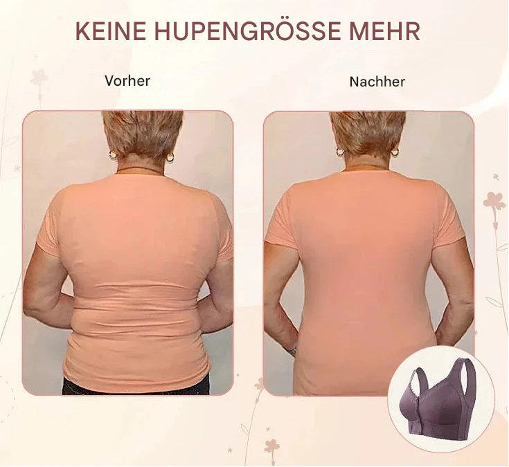 ComfortEase™ Front-Button Bra — Freedom to Dress Effortlessly with All-Day Comfort and Support