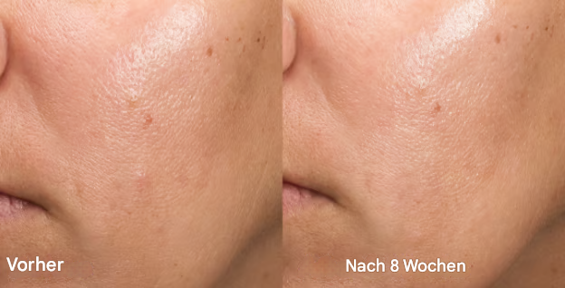 LumaVibe™ — Glow Confidently with Silky, Spot-Free Skin Every Day
