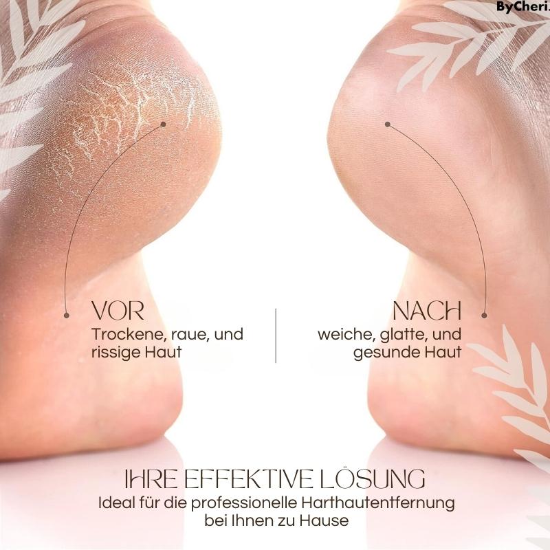 VelvetStep™ — Effortless Salon-Soft Feet That Boost Your Confidence Instantly