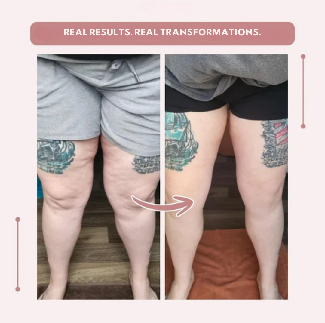 Vibrissea™ — Feel Flawless and Fierce in Every Curve