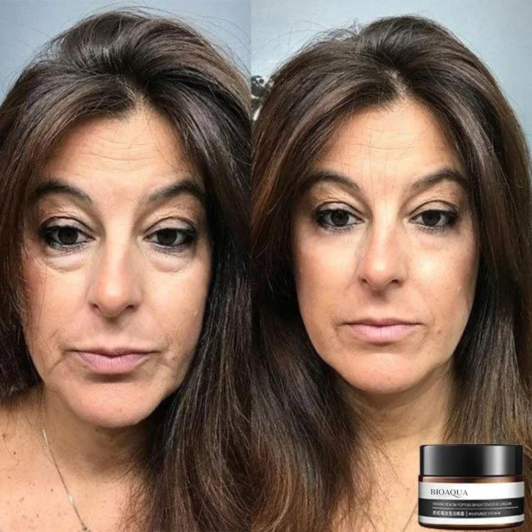 RamoraLuxe™ — Erase Years Instantly for Bright, Youthful Eyes