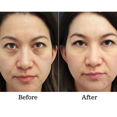 EyeVerra™ — Smooth Away Wrinkles Instantly for Youthful, Radiant Eyes