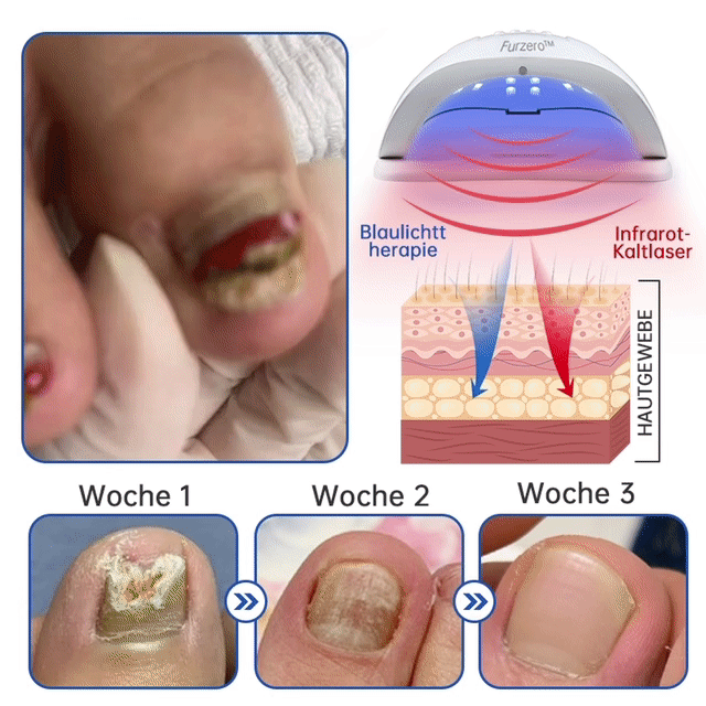 PowerNail™ — Reveal Stunning, Fungus-Free Nails That Command Confidence