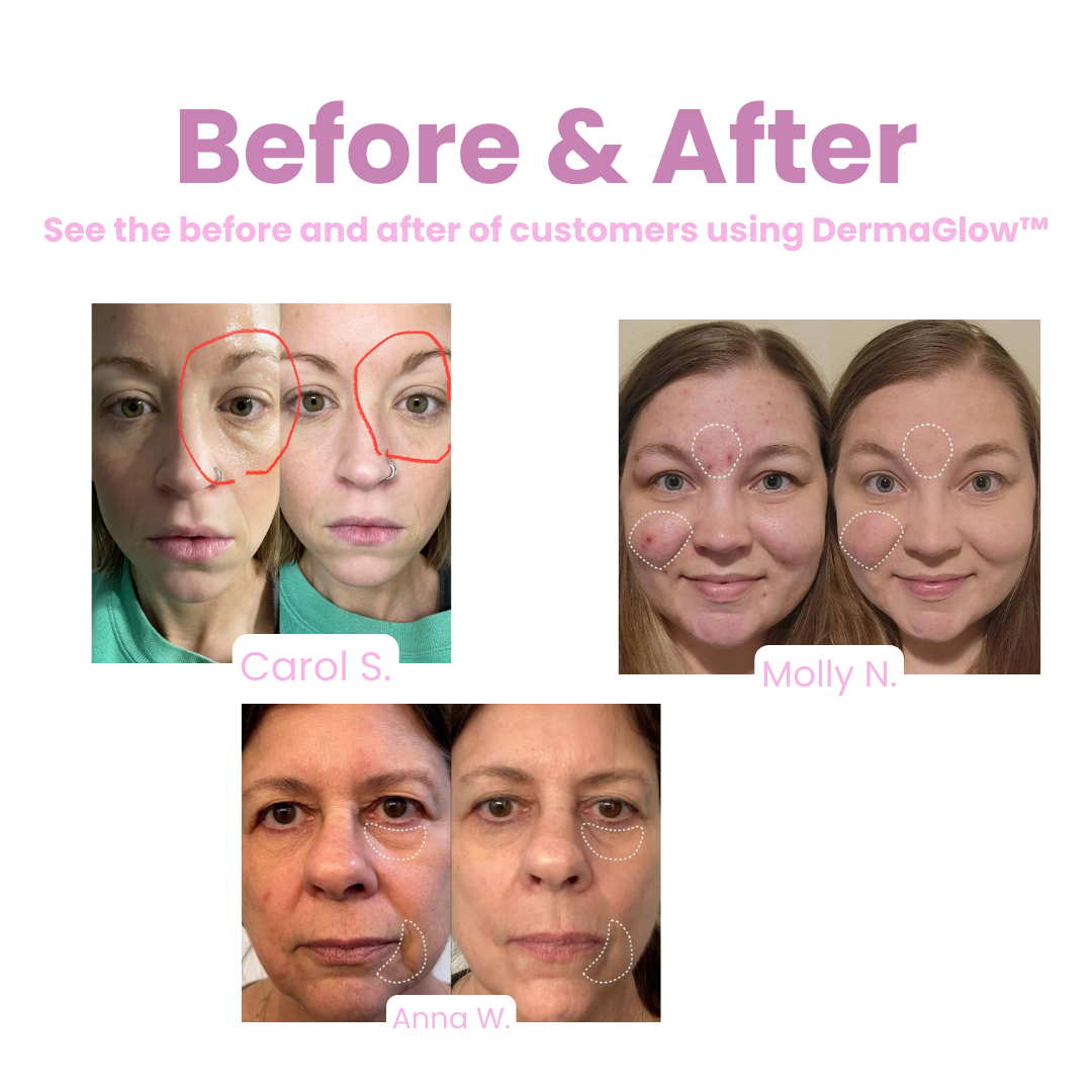 GlowAscend™ — Revitalize Your Skin with Youthful Glow and Confidence in Minutes a Day