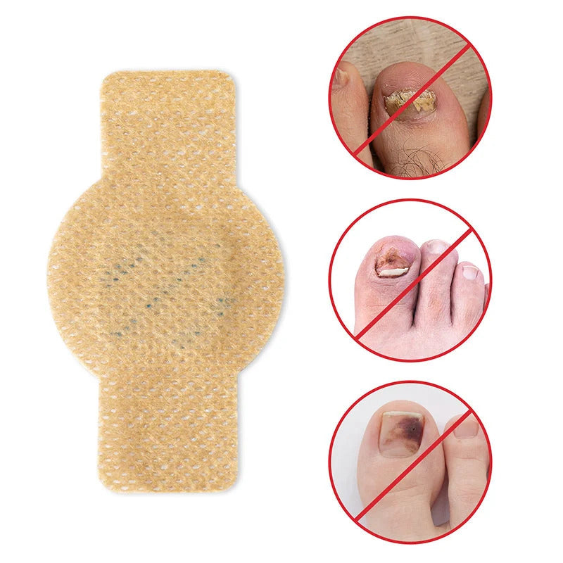 SilkDerm™ Nail Renewal Patches — Clear, Strong Nails That Make You Proud to Bare Your Feet