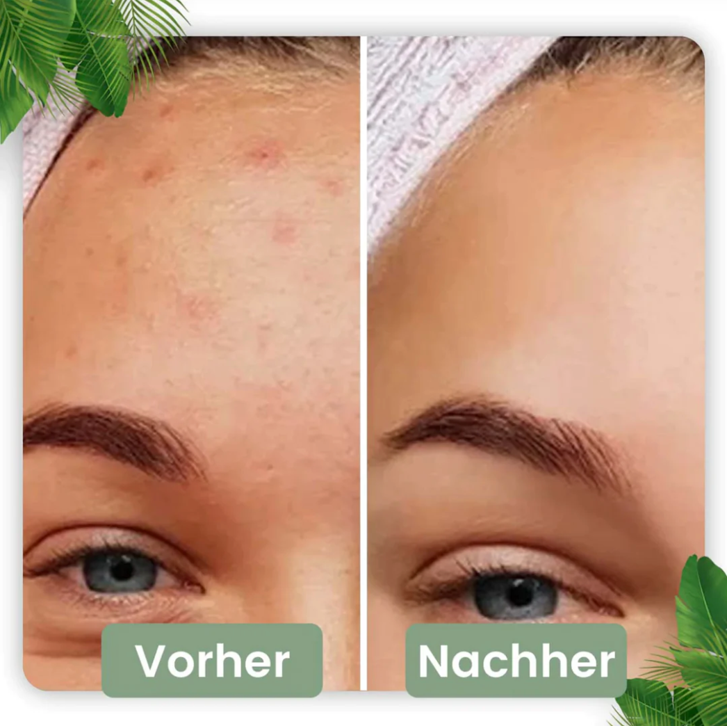 Deep Clean Stick for Radiant Skin | Natural Green Tea Infusion