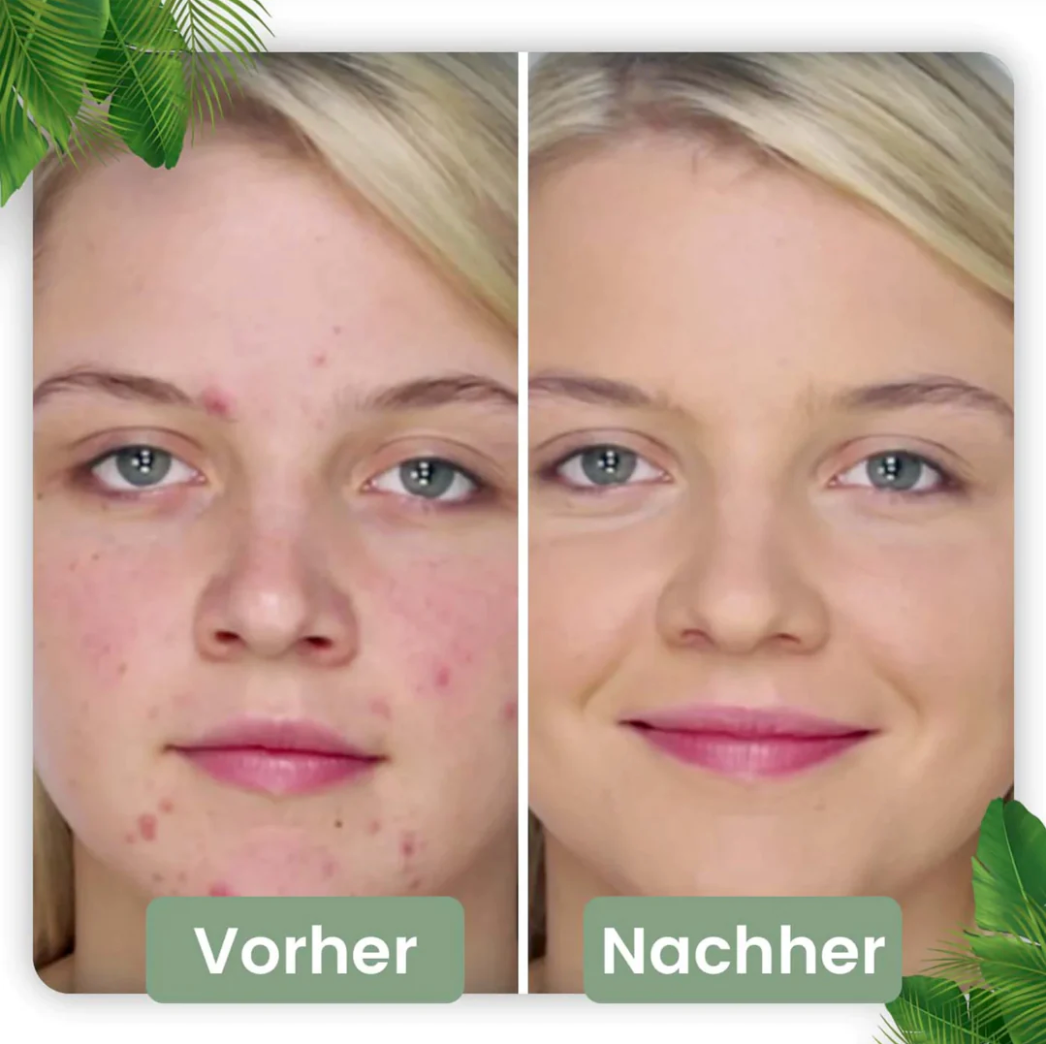 Deep Clean Stick for Radiant Skin | Natural Green Tea Infusion