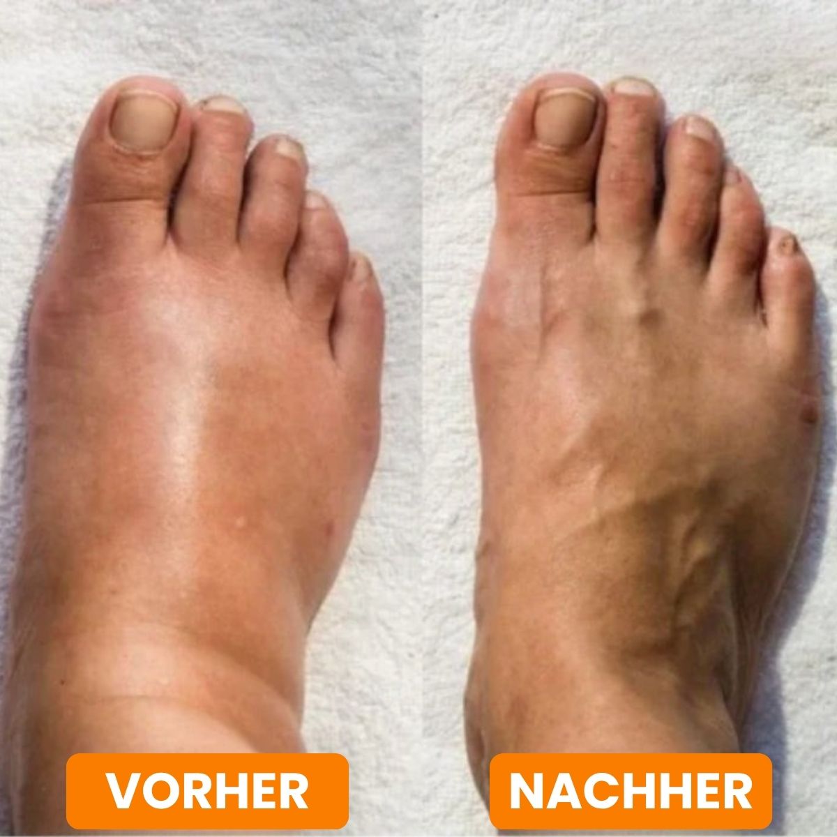 Ultimate Foot Massager for Deep Relaxation | SoleSoothe
