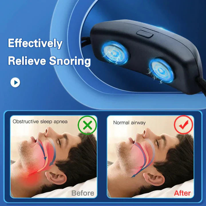 Rechargeable Sleep Harmony Snoring Relief Device with EMS Pulse