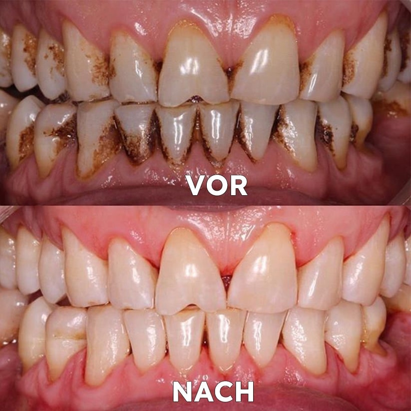 Natural Mineral Powder for Dental Care | Strengthen & Protect Your Smile